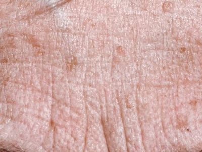 [Facial Skin Aging: an overview of biological aging processes]
